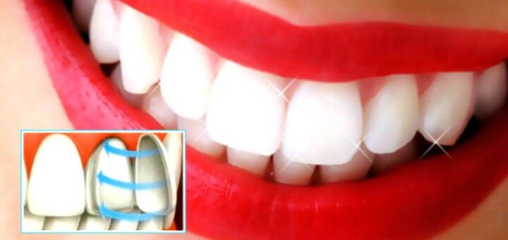 Акции в стоматологической клинике «Nazaria Dental»