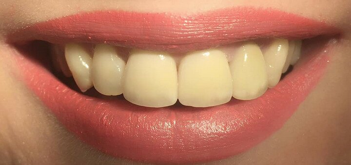 Акции в стоматологической клинике «Smile design»