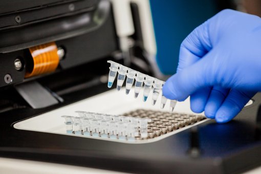 Лабораторія «Invitro». Знижки на аналізи